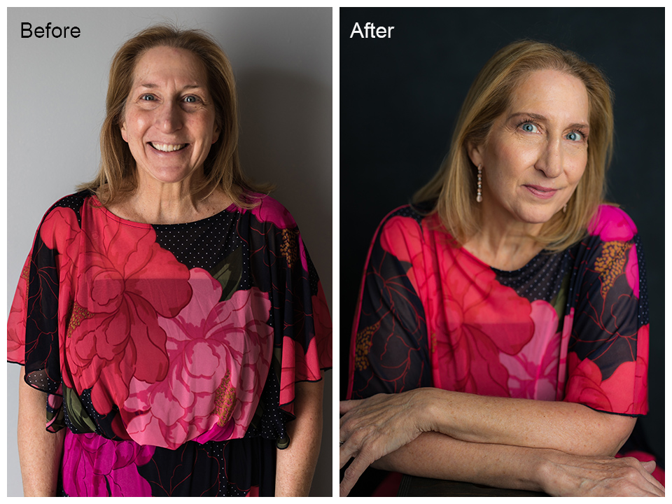 Before & After - Donna